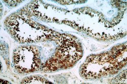 CALCOCO1 Rabbit anti-Human, Mouse, Rat, Polyclonal, Proteintech 150 &mu;L;