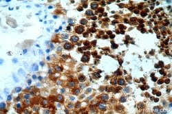 CALCOCO1 Rabbit anti-Human, Mouse, Rat, Polyclonal, Proteintech 150 &mu;L;