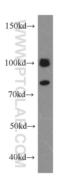 CALCOCO1 Rabbit anti-Human, Mouse, Rat, Polyclonal, Proteintech 150 &mu;L;