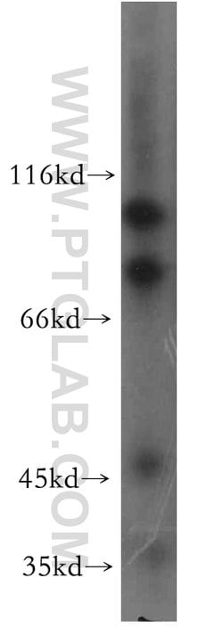 CALCOCO1 Rabbit anti-Human, Mouse, Rat, Polyclonal, Proteintech 150 &mu;L;