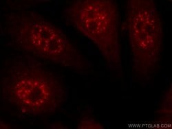 C14orf166 Rabbit anti-Human, Mouse, Rat, Polyclonal, Proteintech 150 &mu;L;