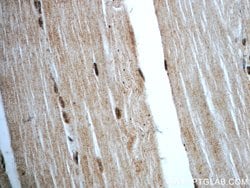 C14orf166 Rabbit anti-Human, Mouse, Rat, Polyclonal, Proteintech 150 &mu;L;