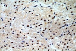 C14orf166 Rabbit anti-Human, Mouse, Rat, Polyclonal, Proteintech 150 &mu;L;
