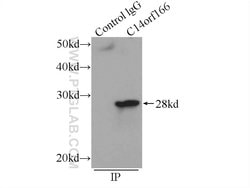 C14orf166 Rabbit anti-Human, Mouse, Rat, Polyclonal, Proteintech 150 &mu;L;