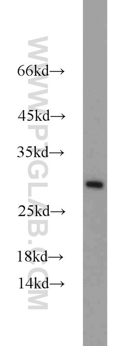 C14orf166 Rabbit anti-Human, Mouse, Rat, Polyclonal, Proteintech 150 &mu;L;