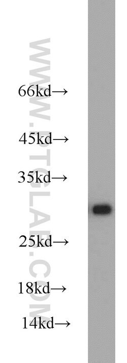 C14orf166 Rabbit anti-Human, Mouse, Rat, Polyclonal, Proteintech 150 &mu;L;