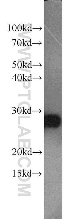 C14orf166 Rabbit anti-Human, Mouse, Rat, Polyclonal, Proteintech 150 &mu;L;