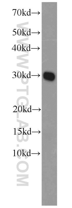 C14orf166 Rabbit anti-Human, Mouse, Rat, Polyclonal, Proteintech 150 &mu;L;