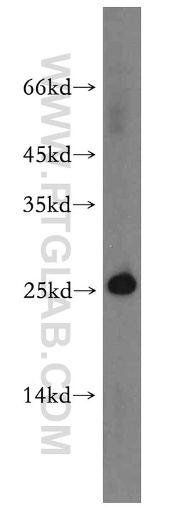 C14orf166 Rabbit anti-Human, Mouse, Rat, Polyclonal, Proteintech 150 &mu;L;