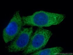 Spermidine synthase Rabbit anti-Human, Mouse, Rat, Polyclonal, Proteintech