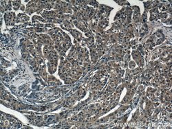 Spermidine synthase Rabbit anti-Human, Mouse, Rat, Polyclonal, Proteintech