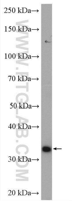 Spermidine synthase Rabbit anti-Human, Mouse, Rat, Polyclonal, Proteintech