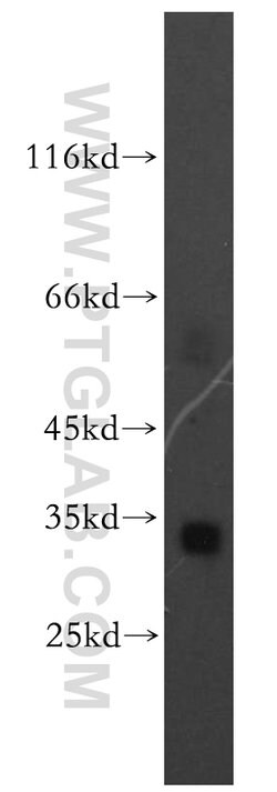 Spermidine synthase Rabbit anti-Human, Mouse, Rat, Polyclonal, Proteintech