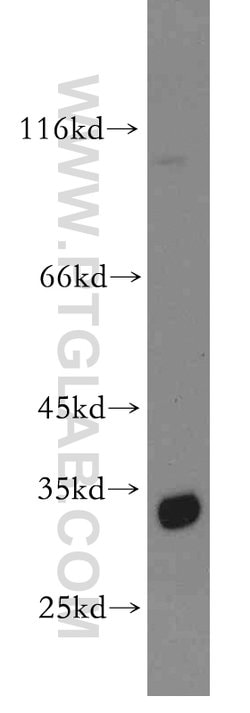 Spermidine synthase Rabbit anti-Human, Mouse, Rat, Polyclonal, Proteintech