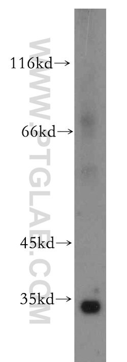 Spermidine synthase Rabbit anti-Human, Mouse, Rat, Polyclonal, Proteintech