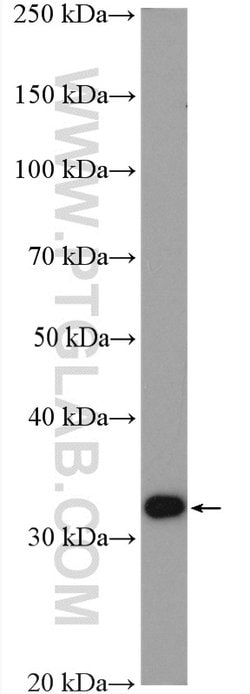 Spermidine synthase Rabbit anti-Human, Mouse, Rat, Polyclonal, Proteintech