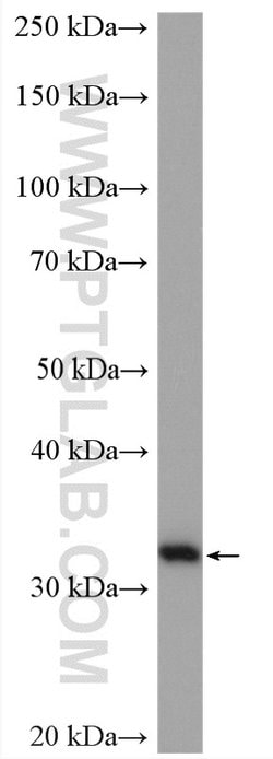 Spermidine synthase Rabbit anti-Human, Mouse, Rat, Polyclonal, Proteintech