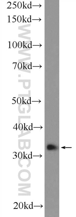 GTF2H3 Rabbit anti-Human, Polyclonal, Proteintech 150 &mu;L; Unconjugated:Antibodies,
