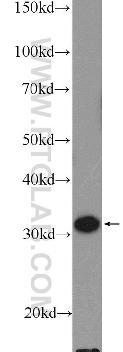 GTF2H3 Rabbit anti-Human, Polyclonal, Proteintech 150 &mu;L; Unconjugated:Antibodies,