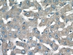 NPC2 Rabbit anti-Human, Mouse, Polyclonal, Proteintech:Antibodies:Primary