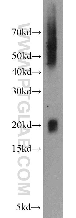 NPC2 Rabbit anti-Human, Mouse, Polyclonal, Proteintech:Antibodies:Primary