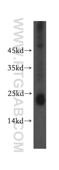 NPC2 Rabbit anti-Human, Mouse, Polyclonal, Proteintech:Antibodies:Primary