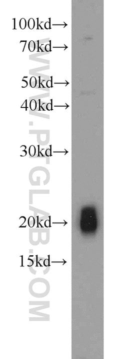 NPC2 Rabbit anti-Human, Mouse, Polyclonal, Proteintech:Antibodies:Primary