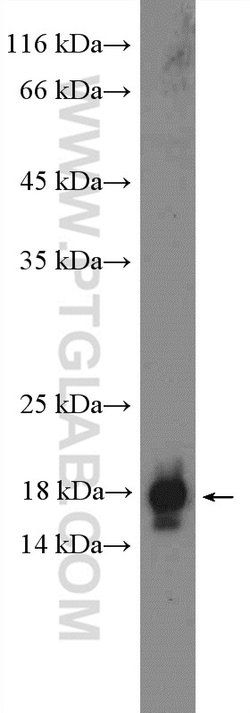 NPC2 Rabbit anti-Human, Mouse, Polyclonal, Proteintech:Antibodies:Primary
