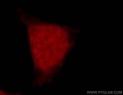 RFWD3 Rabbit anti-Human, Mouse, Rat, Polyclonal, Proteintech:Antibodies:Primary