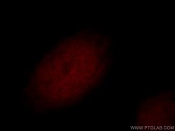 RFWD3 Rabbit anti-Human, Mouse, Rat, Polyclonal, Proteintech:Antibodies:Primary