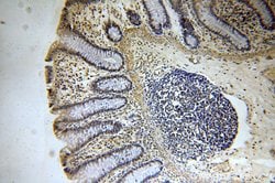 RFWD3 Rabbit anti-Human, Mouse, Rat, Polyclonal, Proteintech:Antibodies:Primary