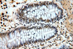 RFWD3 Rabbit anti-Human, Mouse, Rat, Polyclonal, Proteintech:Antibodies:Primary