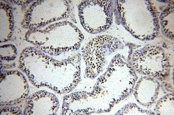 RFWD3 Rabbit anti-Human, Mouse, Rat, Polyclonal, Proteintech:Antibodies:Primary