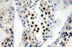 RFWD3 Rabbit anti-Human, Mouse, Rat, Polyclonal, Proteintech:Antibodies:Primary