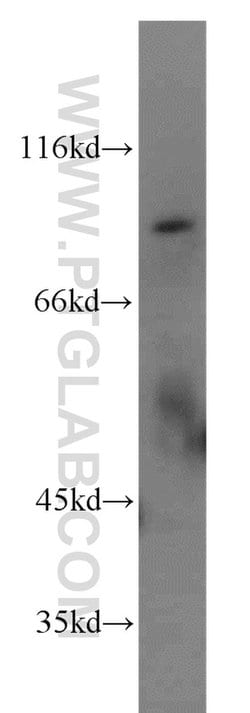RFWD3 Rabbit anti-Human, Mouse, Rat, Polyclonal, Proteintech:Antibodies:Primary