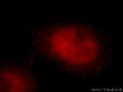 DDX17 Rabbit anti-Human, Mouse, Rat, Polyclonal, Proteintech:Antibodies:Primary