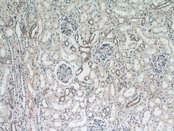 DDX17 Rabbit anti-Human, Mouse, Rat, Polyclonal, Proteintech:Antibodies:Primary