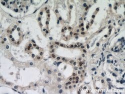 DDX17 Rabbit anti-Human, Mouse, Rat, Polyclonal, Proteintech:Antibodies:Primary