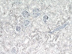 DDX17 Rabbit anti-Human, Mouse, Rat, Polyclonal, Proteintech:Antibodies:Primary