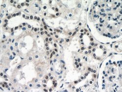 DDX17 Rabbit anti-Human, Mouse, Rat, Polyclonal, Proteintech:Antibodies:Primary