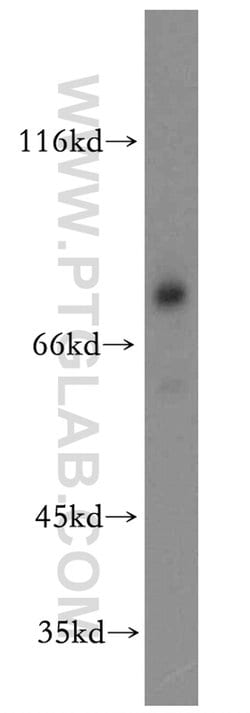 DDX17 Rabbit anti-Human, Mouse, Rat, Polyclonal, Proteintech:Antibodies:Primary