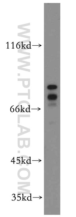 DDX17 Rabbit anti-Human, Mouse, Rat, Polyclonal, Proteintech:Antibodies:Primary