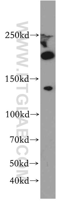 KDM3B Rabbit anti-Human, Mouse, Polyclonal, Proteintech 20 &mu;L; Unconjugated:Antibodies,