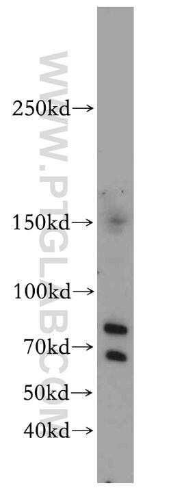 KDM3B Rabbit anti-Human, Mouse, Polyclonal, Proteintech 20 &mu;L; Unconjugated:Antibodies,