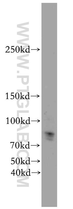 KDM3B Rabbit anti-Human, Mouse, Polyclonal, Proteintech 20 &mu;L; Unconjugated:Antibodies,