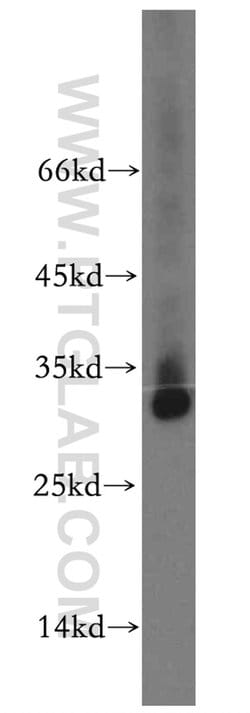 TMEM38A Rabbit anti-Human, Mouse, Rat, Polyclonal, Proteintech