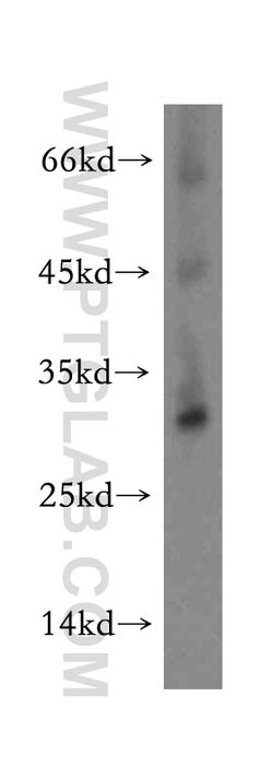 TMEM38A Rabbit anti-Human, Mouse, Rat, Polyclonal, Proteintech:Anticuerpos:Anticuerpos