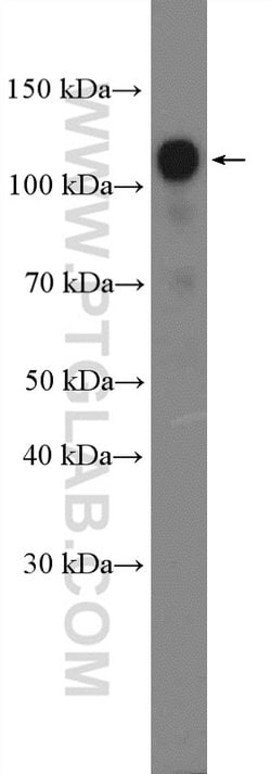 RBM5 Rabbit anti-Human, Mouse, Rat, Polyclonal, Proteintech 150 &mu;L | Buy Online | Proteintech Group Inc | Fisher Scientific