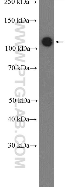 RBM5 Rabbit anti-Human, Mouse, Rat, Polyclonal, Proteintech 150 &mu;L | Buy Online | Proteintech Group Inc | Fisher Scientific