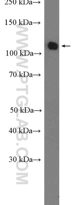 RBM5 Rabbit anti-Human, Mouse, Rat, Polyclonal, Proteintech 150 &mu;L | Buy Online | Proteintech Group Inc | Fisher Scientific